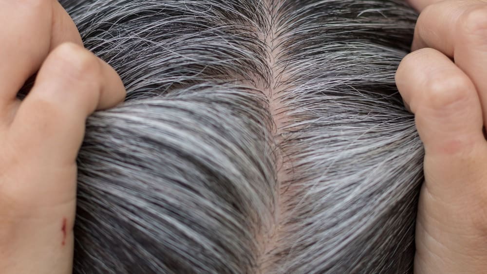 showing white hair growth